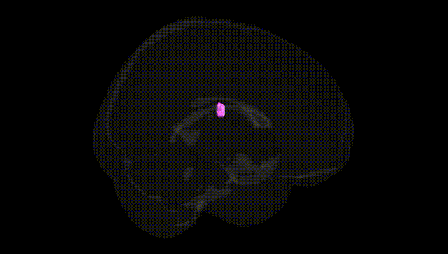 Full Brain Black