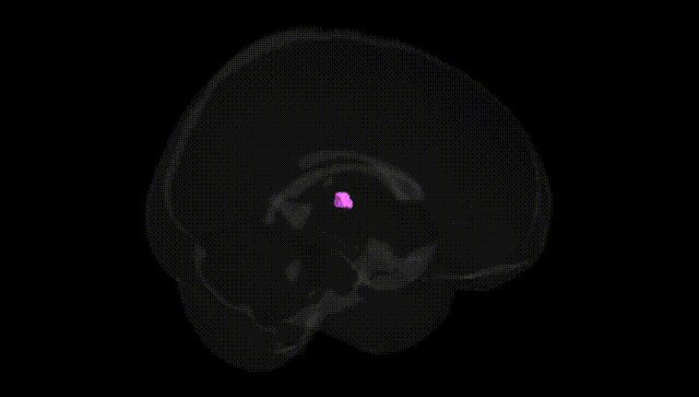 Full Brain Black