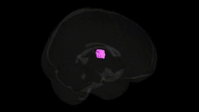 Full Brain Black