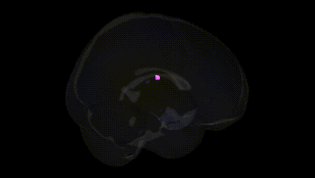 Full Brain Black