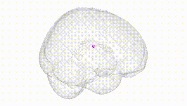 Full Brain White