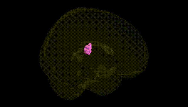 Full Brain Black