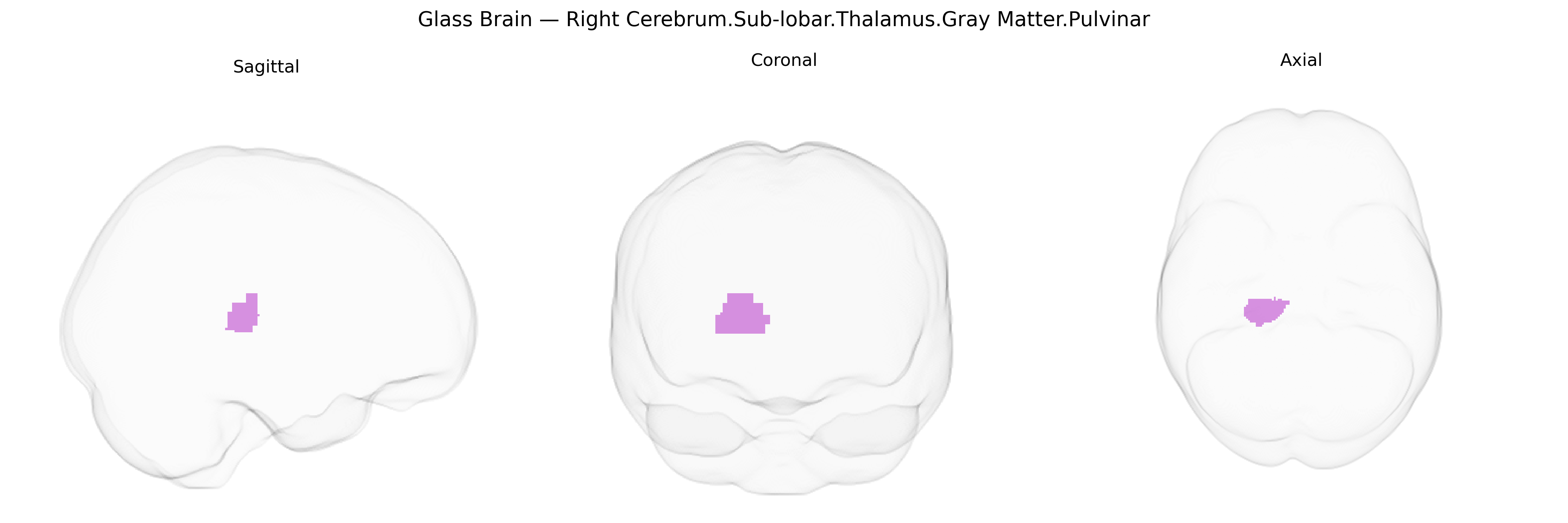 Triplanar Ghost Brain