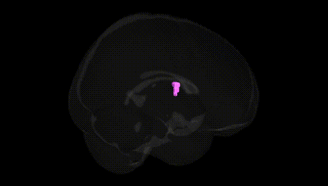 Full Brain Black