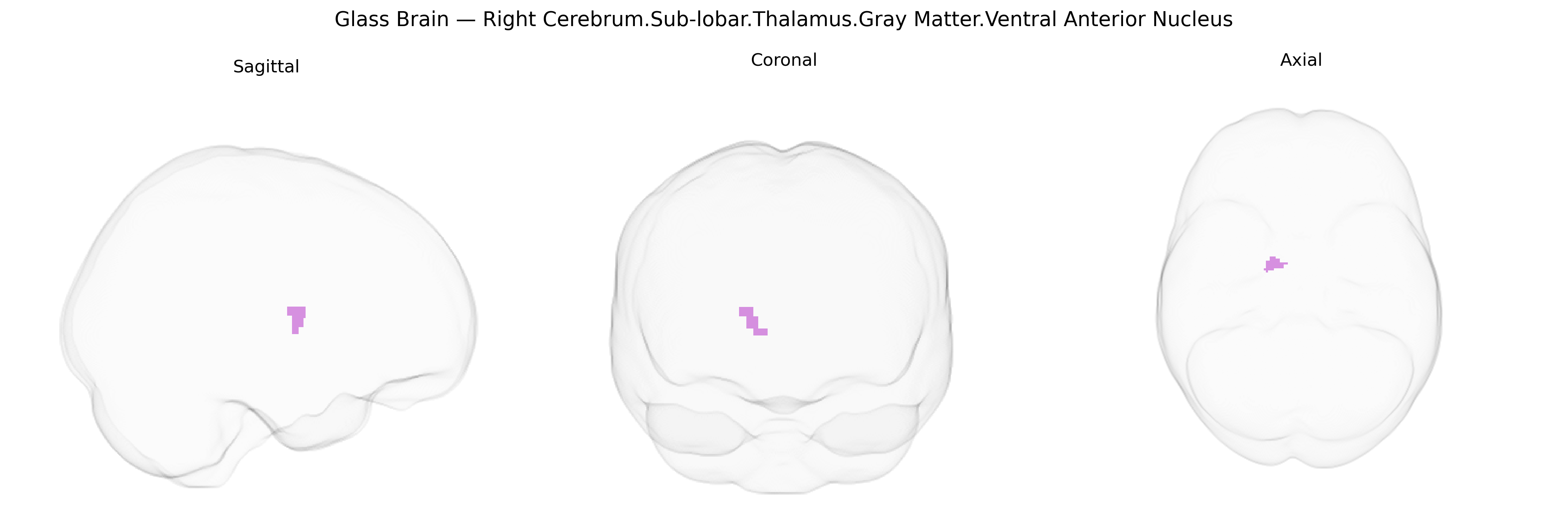 Triplanar Ghost Brain