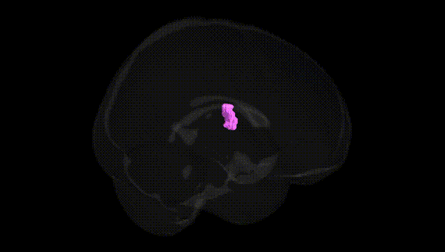 Full Brain Black