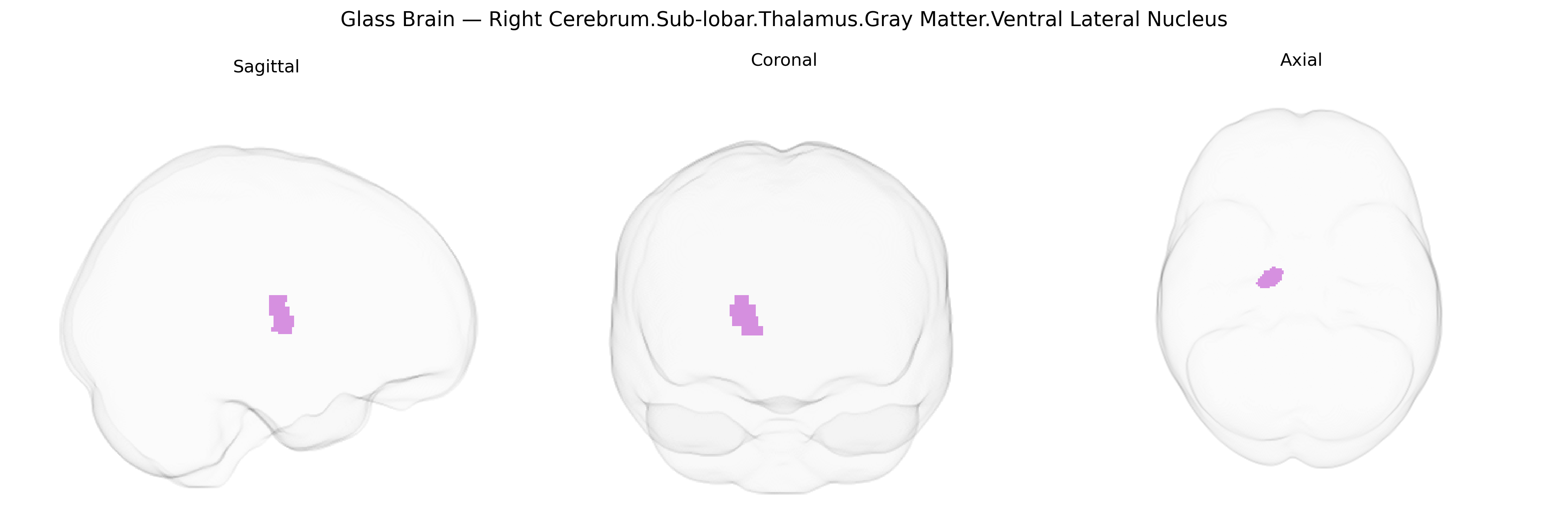 Triplanar Ghost Brain