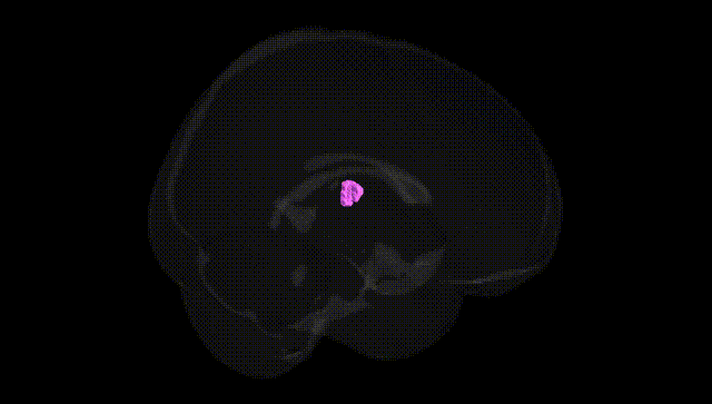 Full Brain Black