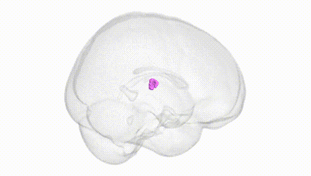 Full Brain White
