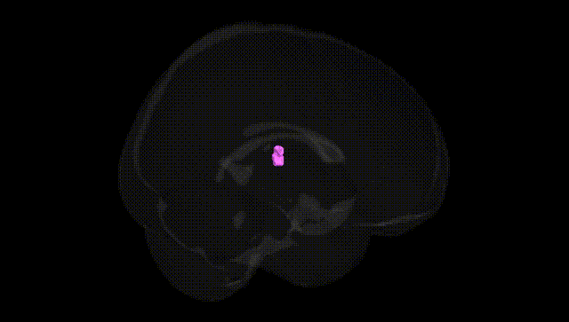Full Brain Black