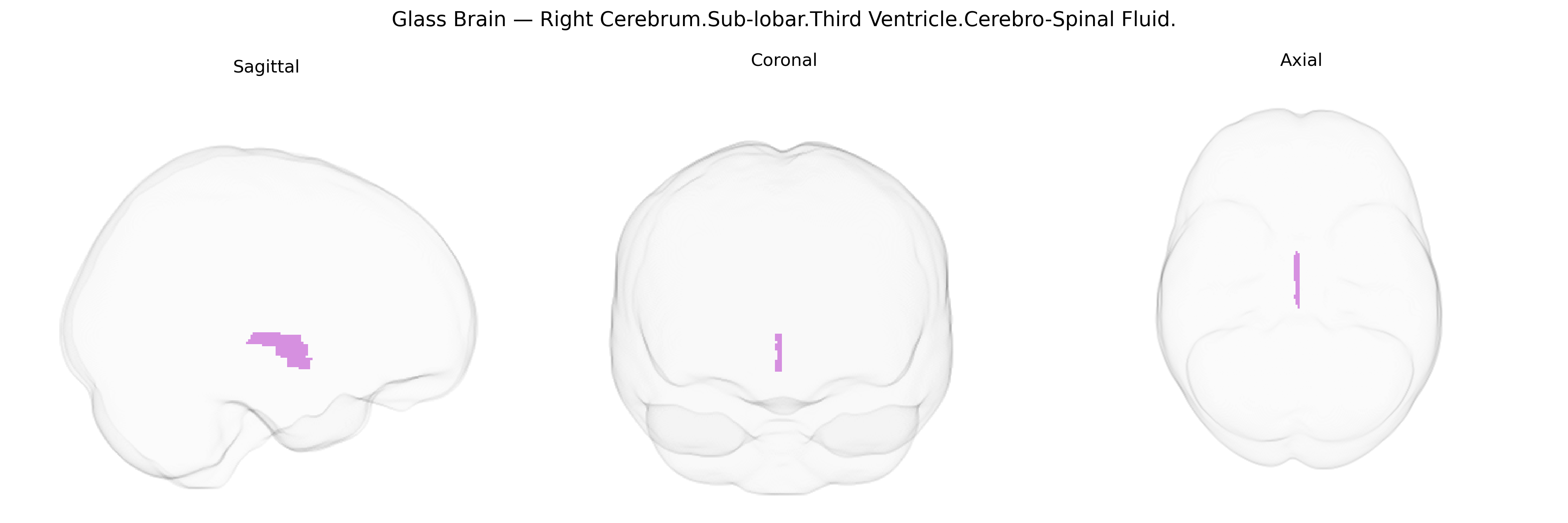 Triplanar Ghost Brain