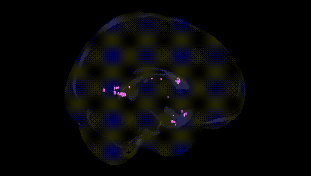 Full Brain Black