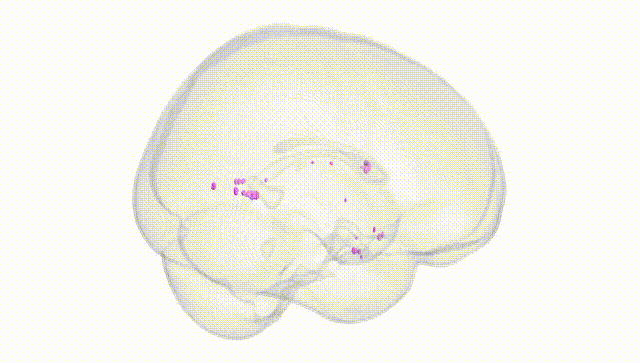 Full Brain White