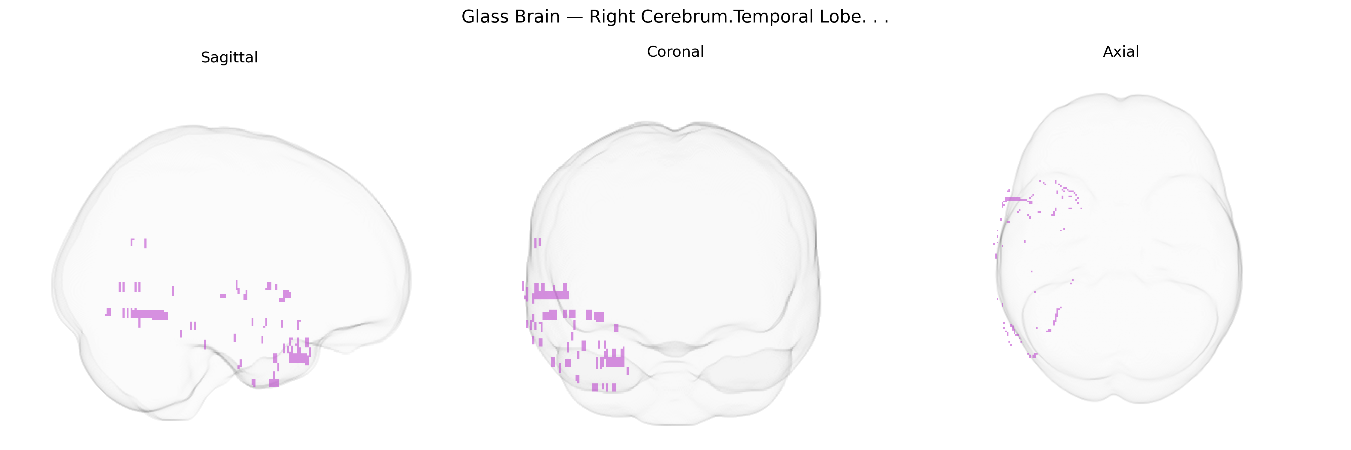Triplanar Ghost Brain