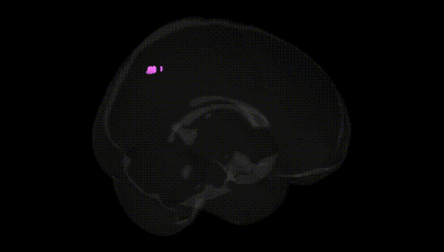 Full Brain Black