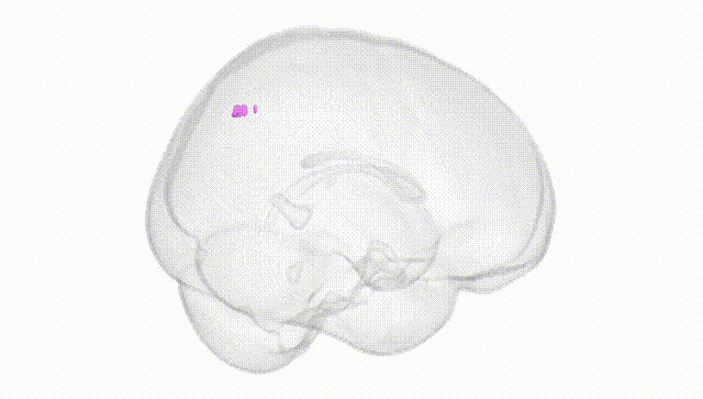Full Brain White