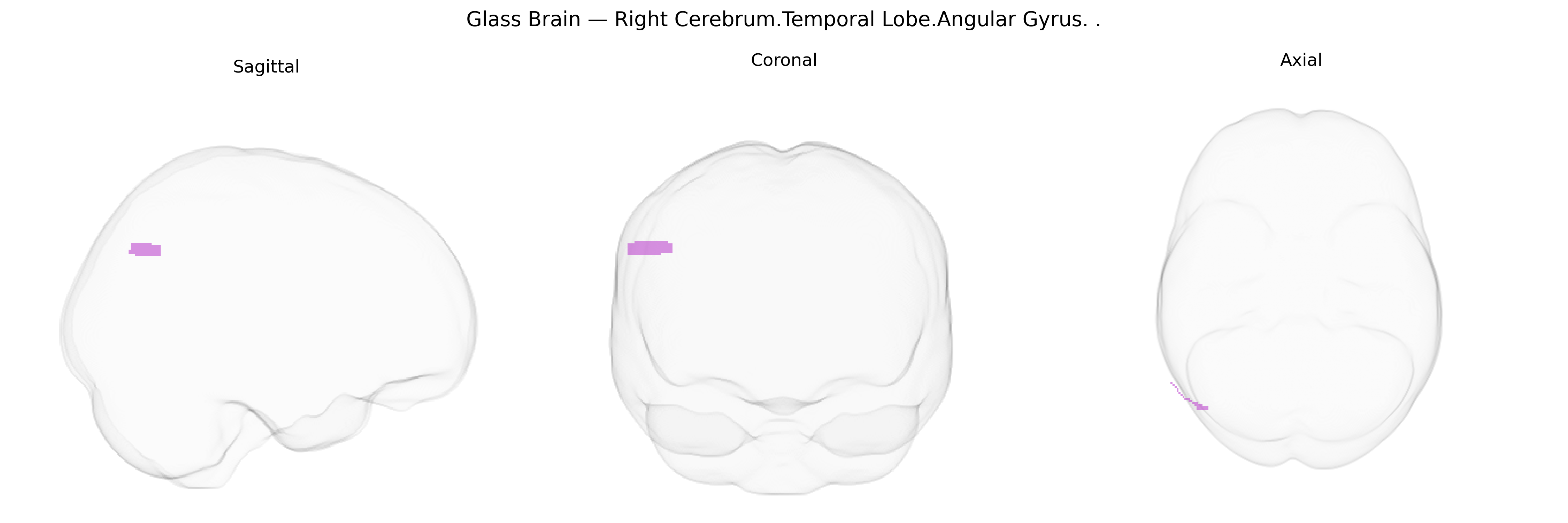 Triplanar Ghost Brain