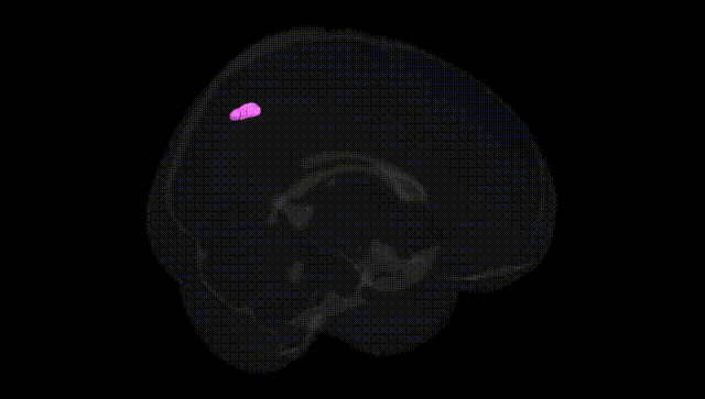 Full Brain Black