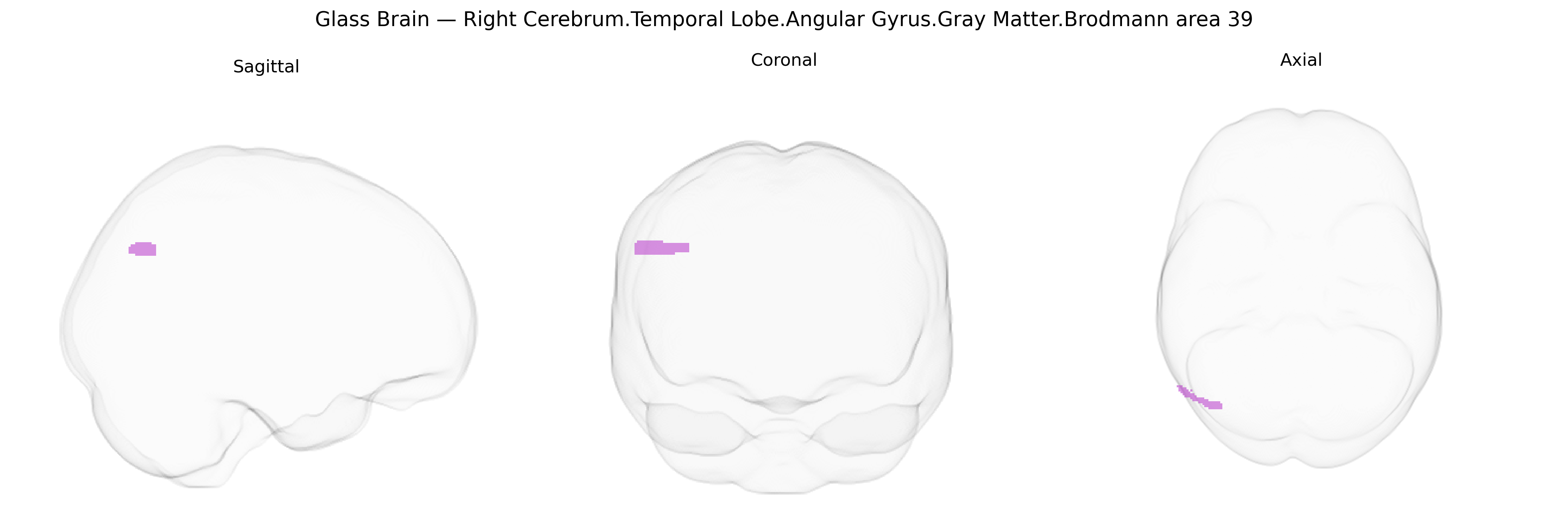 Triplanar Ghost Brain