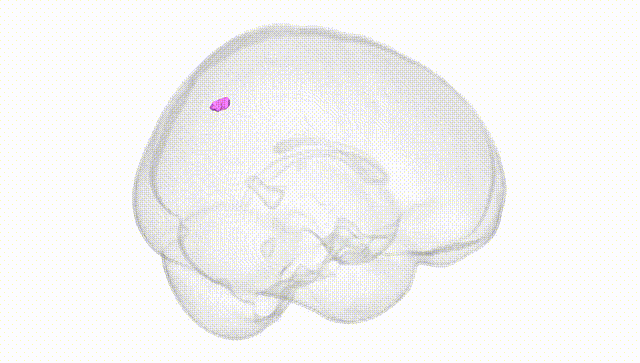 Full Brain White