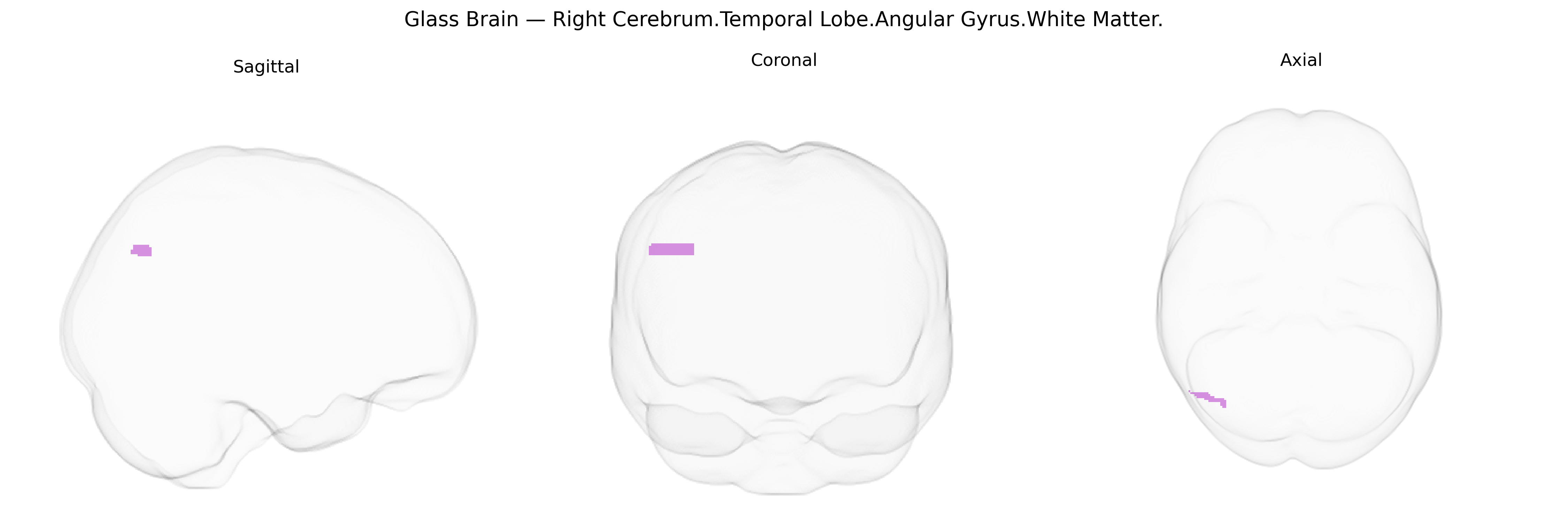 Triplanar Ghost Brain