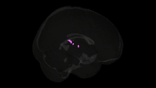 Full Brain Black