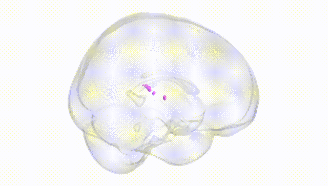Full Brain White