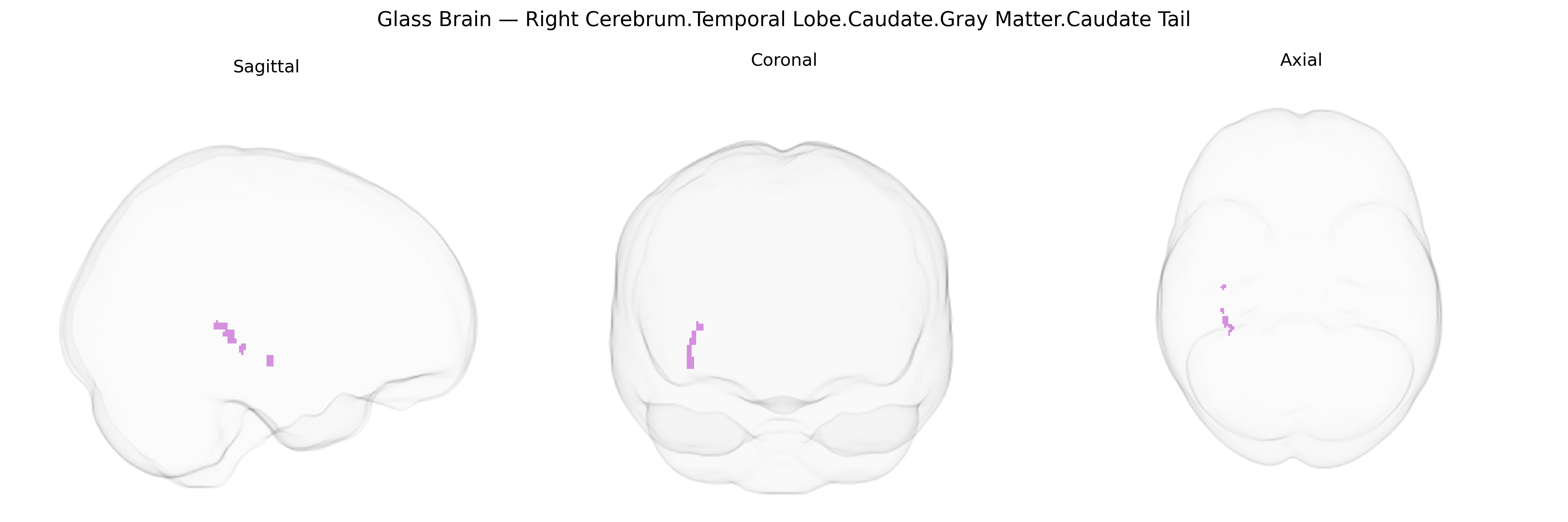 Triplanar Ghost Brain