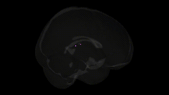 Full Brain Black