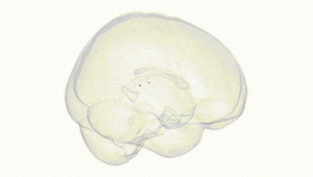 Full Brain White