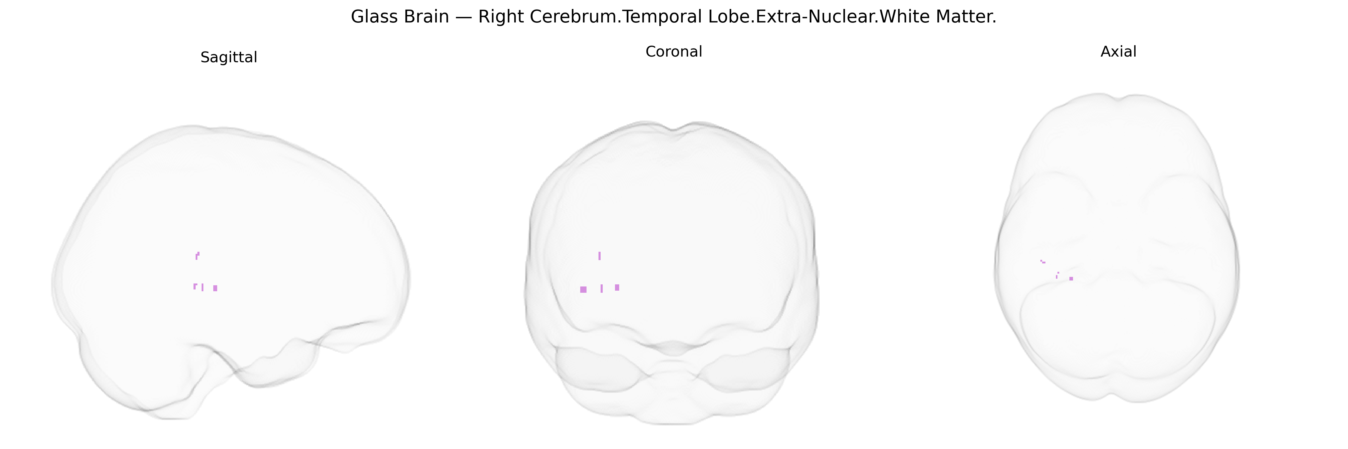 Triplanar Ghost Brain