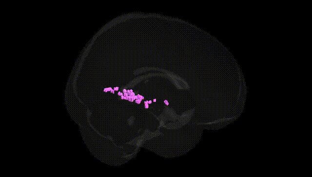Full Brain Black