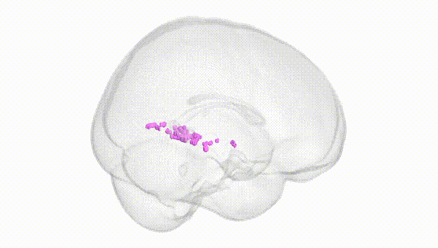 Full Brain White