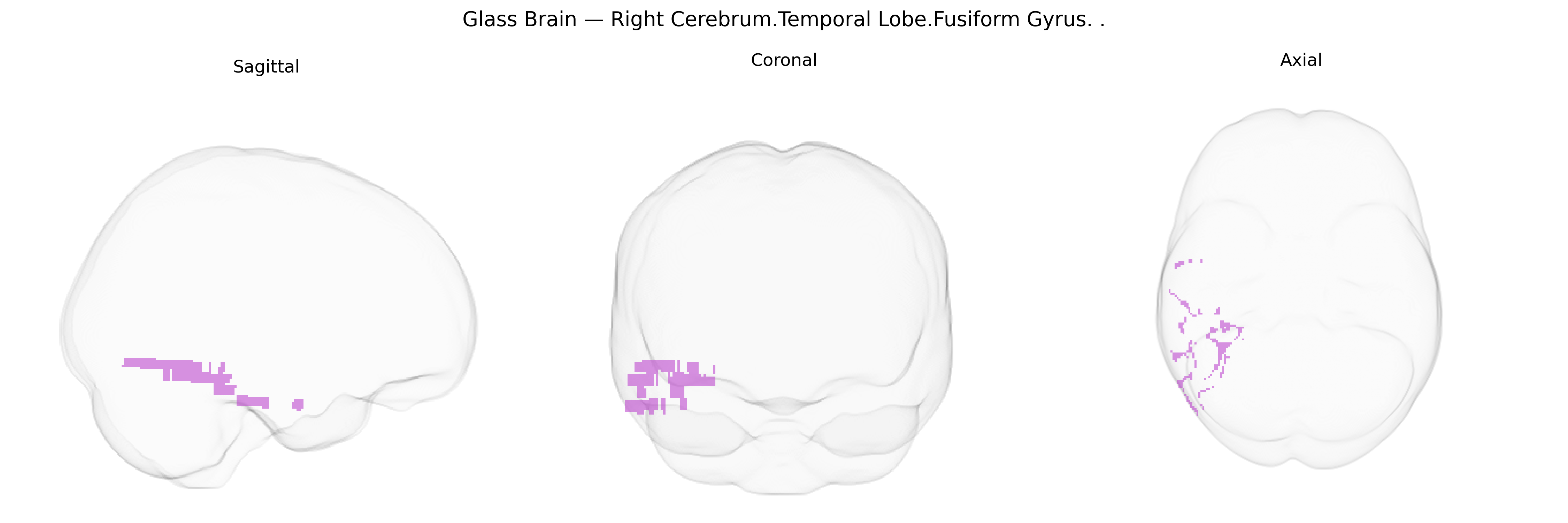 Triplanar Ghost Brain