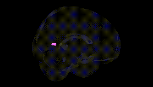 Full Brain Black