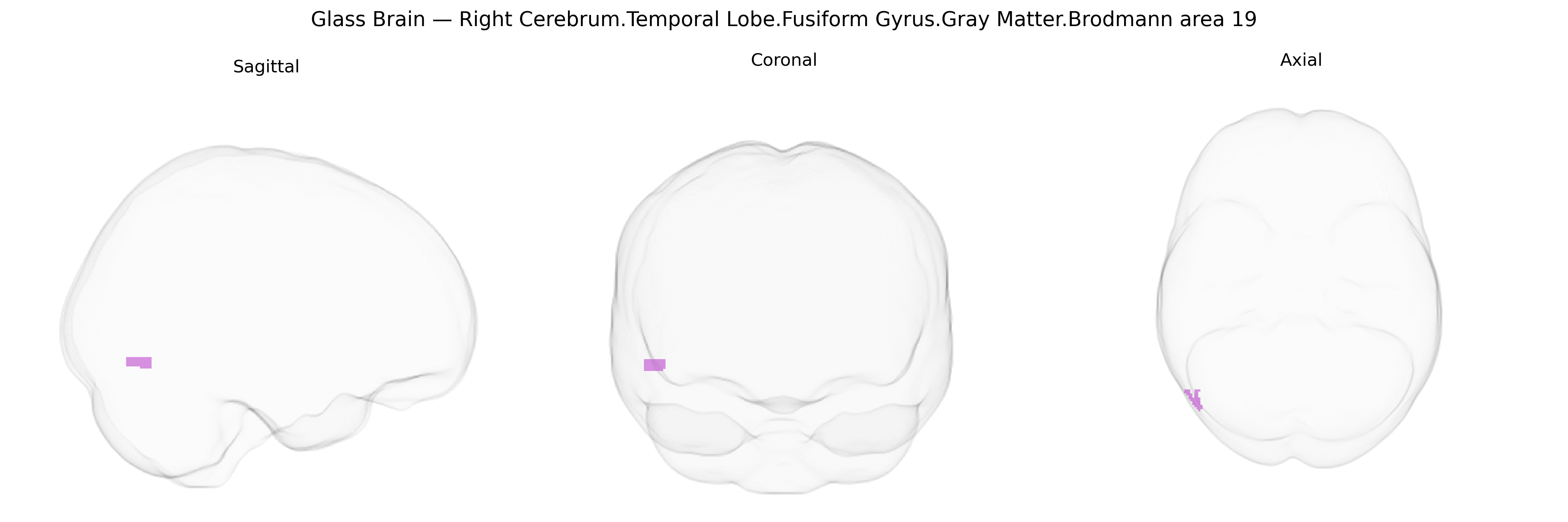 Triplanar Ghost Brain
