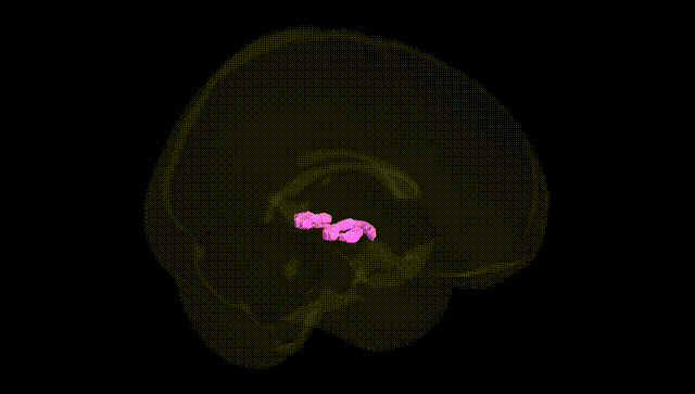 Full Brain Black