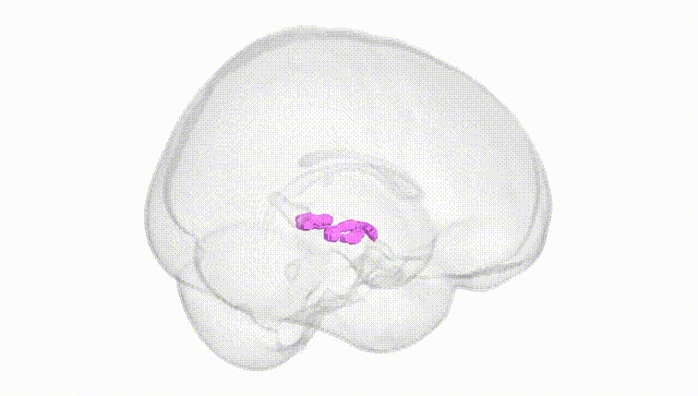 Full Brain White