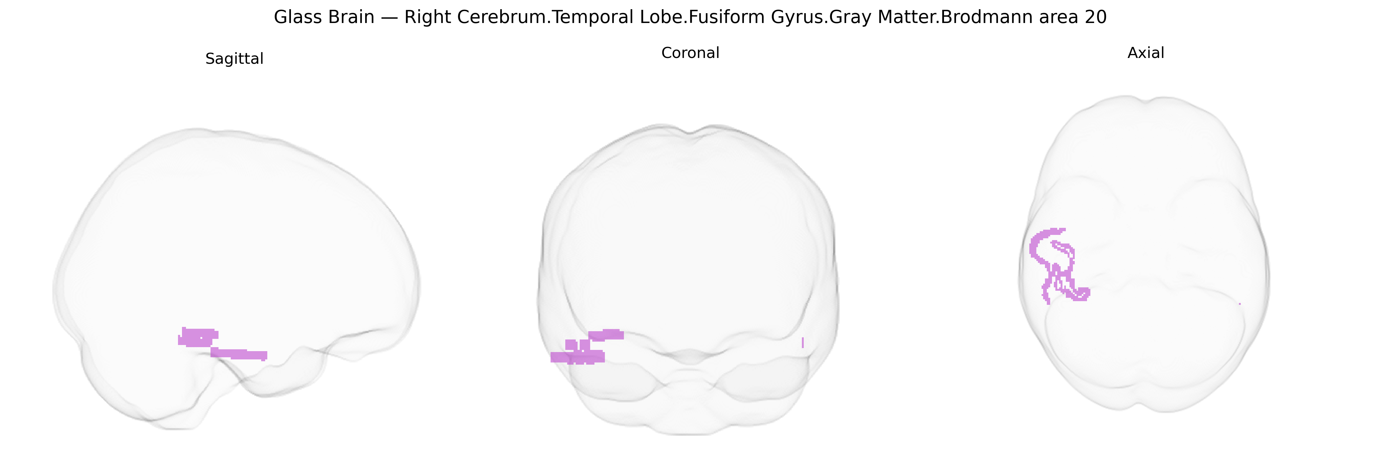 Triplanar Ghost Brain
