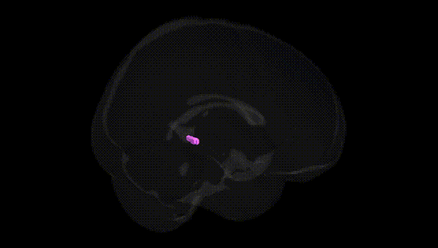 Full Brain Black