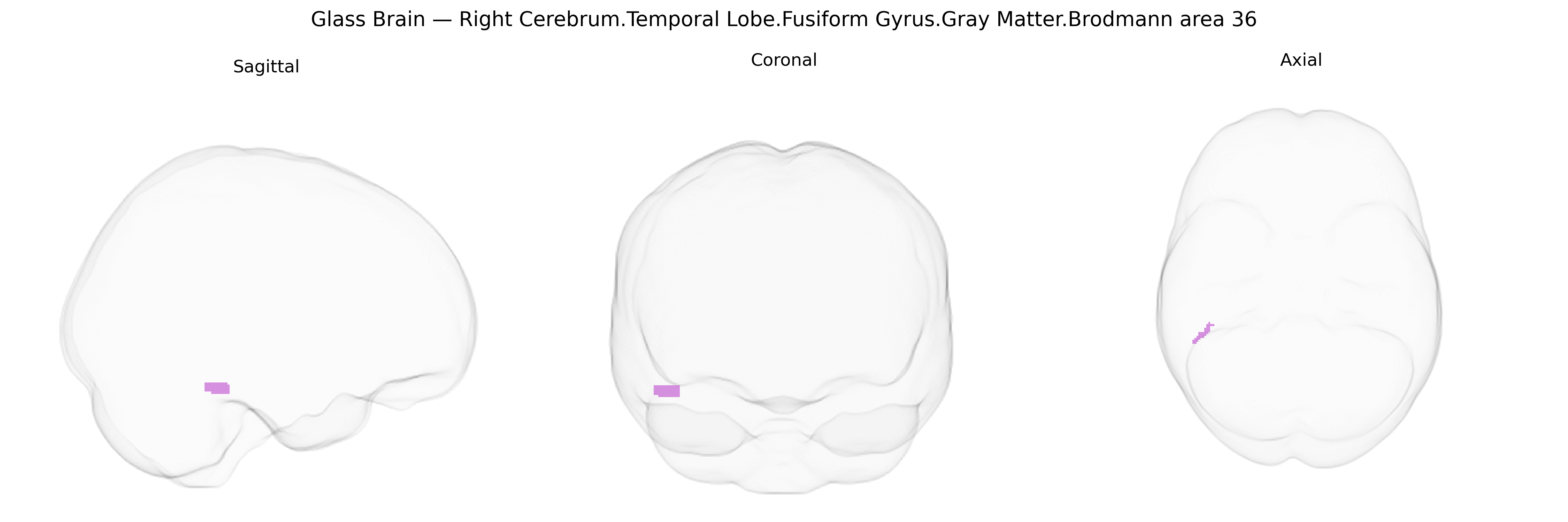 Triplanar Ghost Brain