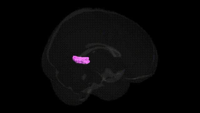 Full Brain Black