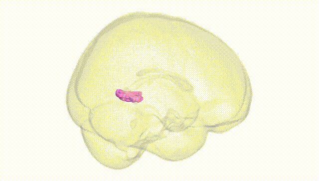 Full Brain White