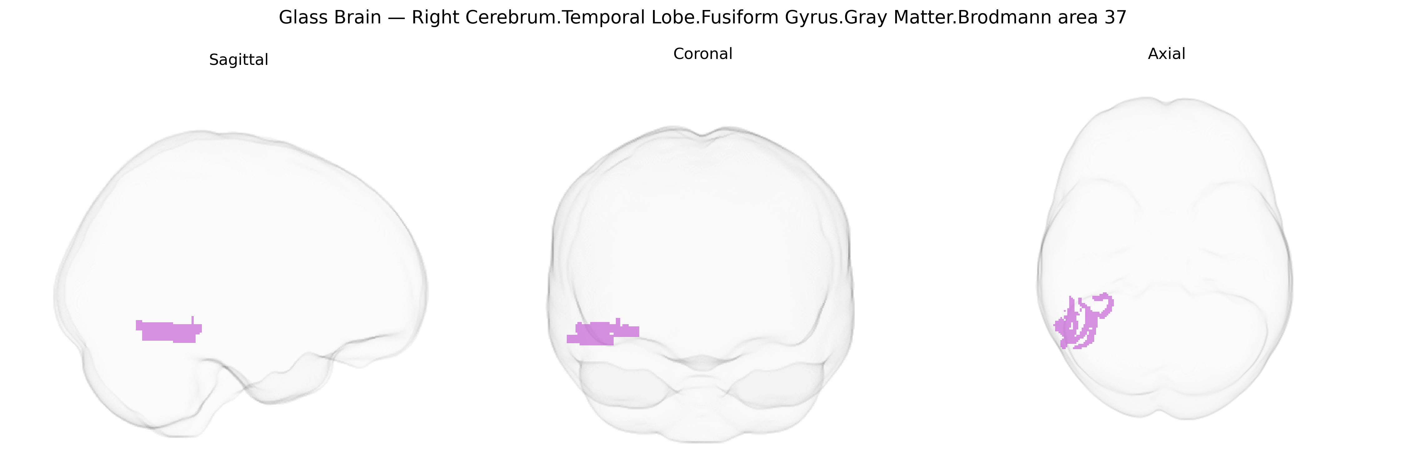 Triplanar Ghost Brain