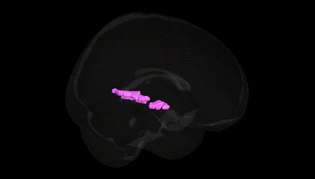 Full Brain Black