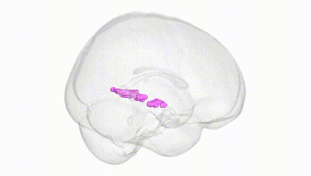 Full Brain White