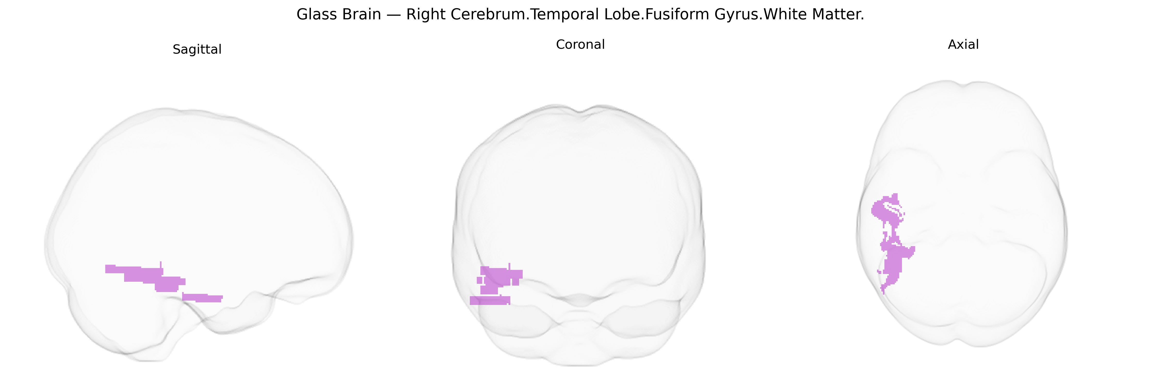 Triplanar Ghost Brain