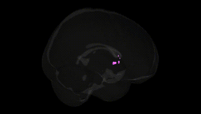 Full Brain Black