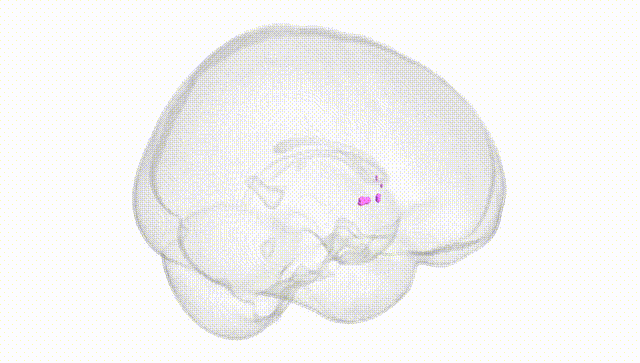 Full Brain White