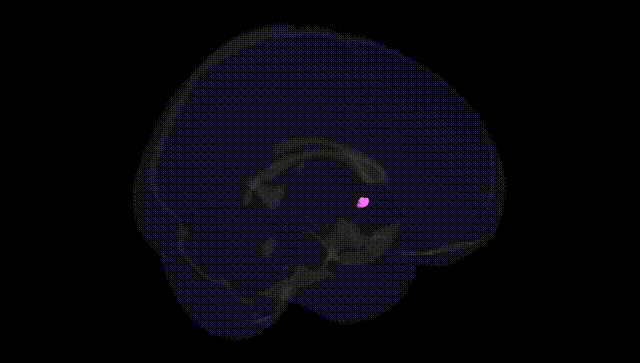 Full Brain Black